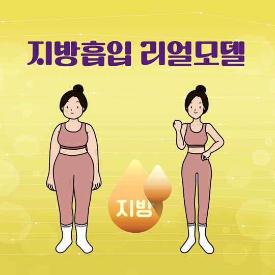 지방흡입 리얼모델